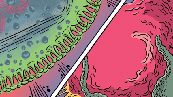 Nova terapia usa v&iacute;rus da herpes para combater melanoma