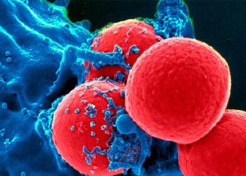 Anvisa aprova novas indica&ccedil;&otilde;es do agente anti-PD-1 pembrolizumabe