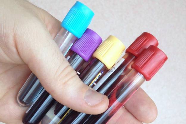 A bi&oacute;psia l&iacute;quida no monitoramento dos pacientes com c&acirc;ncer