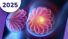 Mama: doença localizada adjuvância