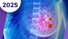 Mama: doença localizada neoadjuvância