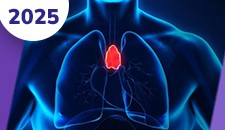 Neoplasias malignas do timo