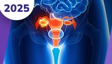 Ovário: tumores germinativos