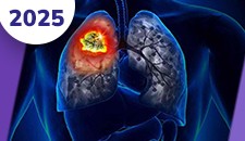 Pulmão não-pequenas células: doença localizada e localmente avançada