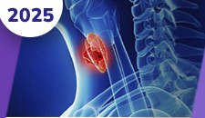 Carcinoma de tireoide: medular