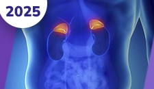 Carcinomas da adrenal, feocromocitomas e paragangliomas
