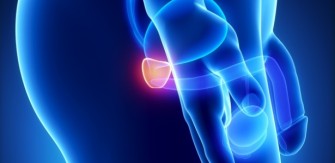 Consenso brasileiro sobre câncer de próstata